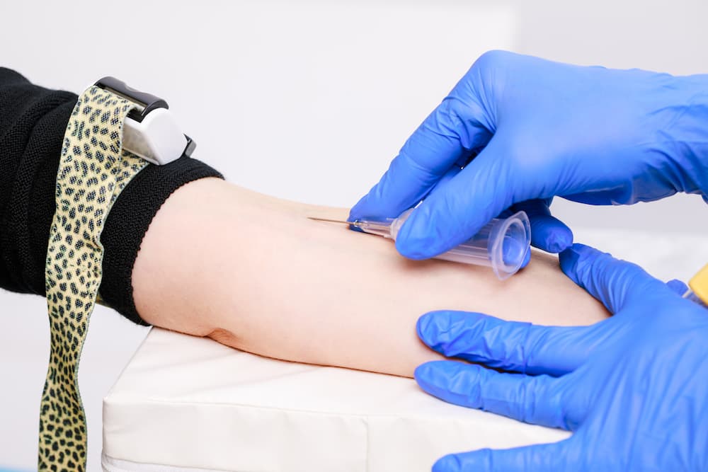 Featured image for post: A Step-by-Step Guide to Venipuncture